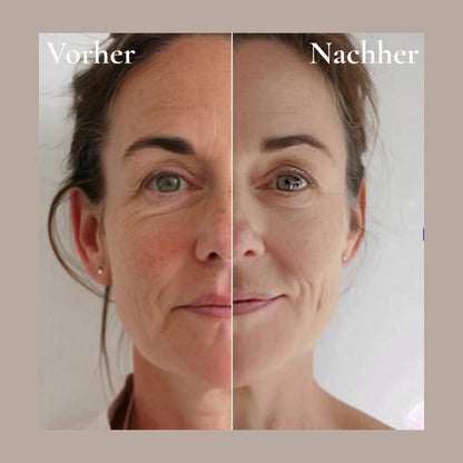 GlowLuxe™ LymphLift