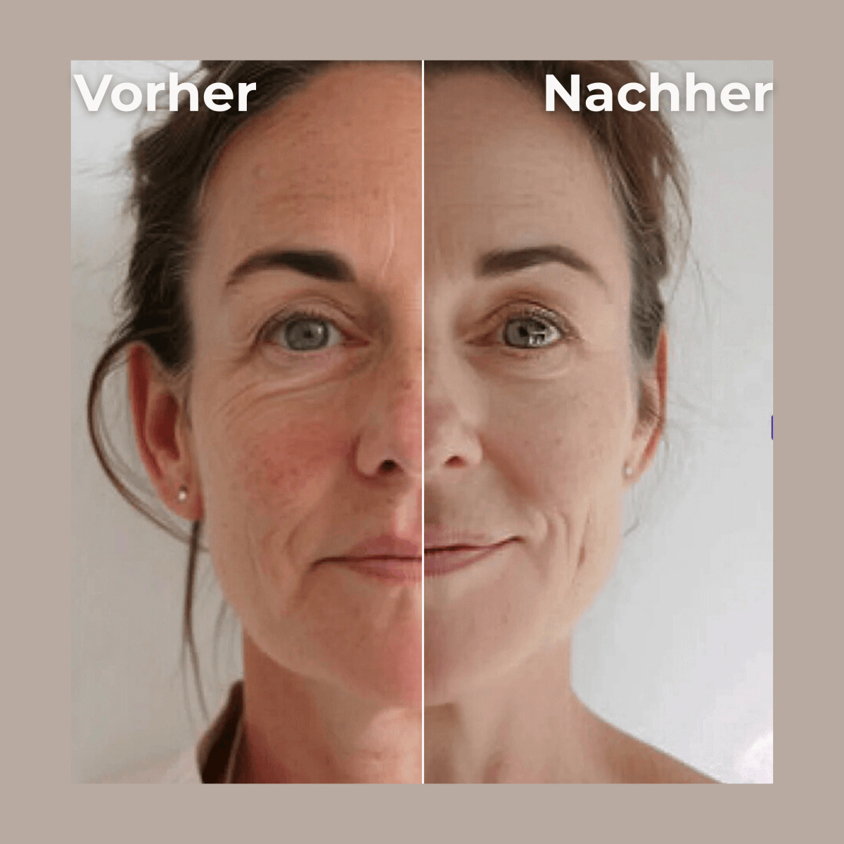 GlowLuxe™ LymphLift - GlowLuxe