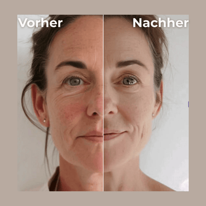 GlowLuxe™ LymphLift - GlowLuxe