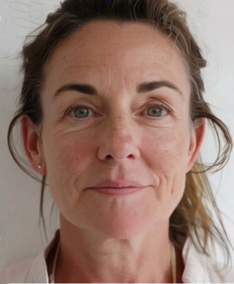 Vorher Bild Gesicht